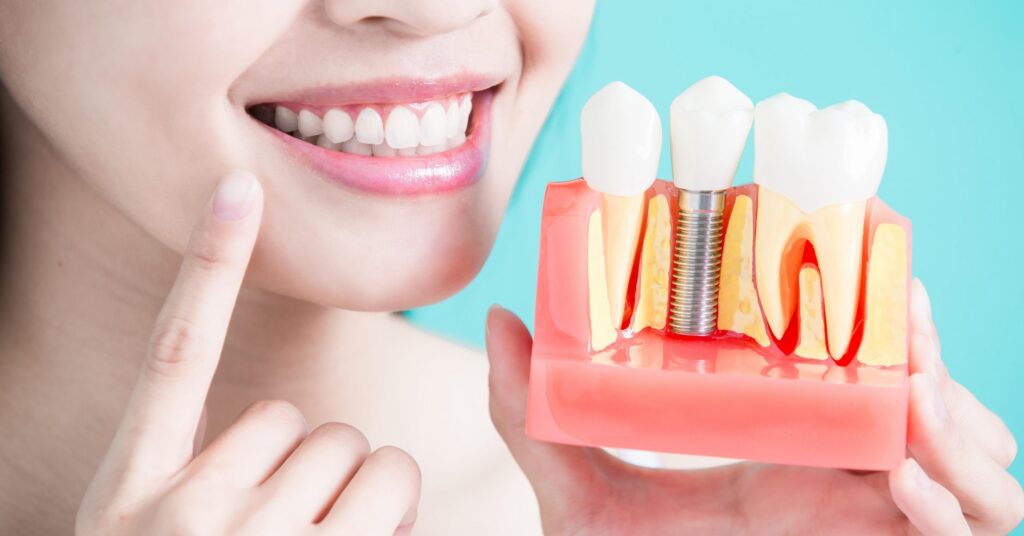 Implantology Dentistry