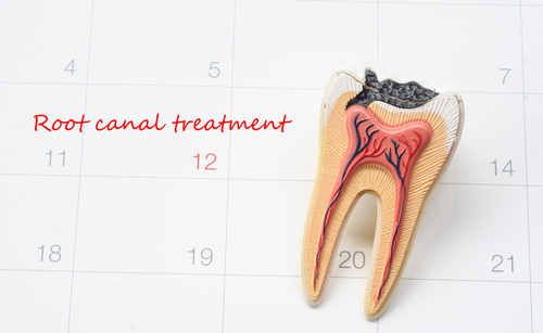 Uncovering Root Canal Signs