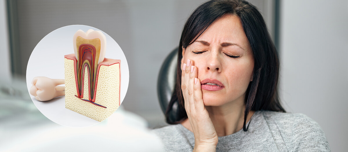 Root Canal Treatment