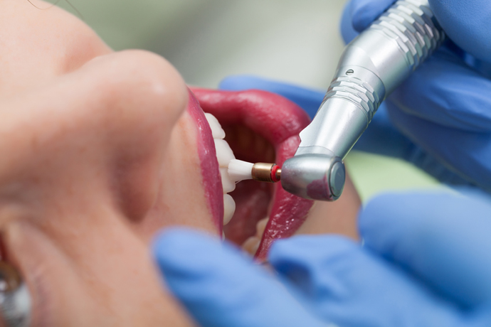 What is dental therapy